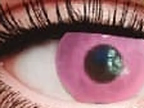 Lente de contacto de color Anyday ZY-901: neón lila, en un ojo
