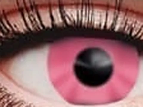 Lente de contacto de color Anyday ZY-911: neón rosado, en un ojo